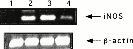 Fig. 2. iNOS gene expression in unstimulated and IL-12- or/and TNF-treated NK cells. NK cells were stimulated for 7 hours in the absence (lane 1) or presence of IL-12 (5 U/mL) (lane 2), IL-12 and TNF (lane 3), or TNF (20 ng/mL) (lane 4), and then mRNA was extracted. The presence of iNOS mRNA was analyzed by RT-PCR, as described in Materials and Methods. Data are from one representative experiment of seven that gave comparable results.