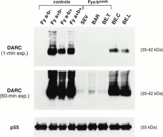 Fig. 2. Immunoblot analysis of RBC membrane proteins. Total membrane proteins (60 μg) separated on SDS-PAGE were blotted on nitrocellulose sheets and incubated with the murine anti-Fy6 MoAb i3A and with a rabbit anti-p55 antibody. The DARC glycoproteins and p55 proteins were visualized by chemioluminescence autoradiography using goat antimouse or goat antirabbit IgG conjugated to horseradish peroxidase, as second antibodies, respectively. The 35- to 45-kD DARC glycoprotein forms aggregates migrating as bands of 90 and 200 kD.45