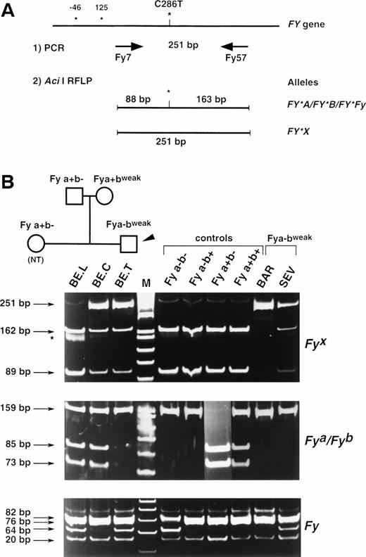 Fig. 4. Full Duffy DNA typing. (A) Strategy of the PCR-RFLP for the detection of the C286T substitution specific of FY*X allele. Primers Fy7 and Fy57 were designed to amplify a 251-bp FYfragment encompassing the single base substitution identified between the Fy(a−b+) and Fy(a−bweak) clones and that was correlated with an allele-specific Aci I restriction site. Nucleotide numbers are as in Fig 3 and do not take into account the intronic sequence of the FY gene. (B) DNA from donors with the indicated Duffy phenotype was used as templates in PCR-RFLP assays. Ten donors with each control phenotypes were analyzed and typical results are shown. The detection of the FY*A-, FY*B-, andFY*Fy-associated polymorphisms (G125A and C-46T, respectively) were based on Ban I and Sty I RFLP, as previously described, with some modifications for FY*Fy typing (see Materials and Methods). The TAR sample gave the same RFLP pattern as SEV and BE.T. The tree of the BE. family is shown to follow the inheritance of the FY*X mutation and to demonstrate that the presence at the heterozygous state of the silent allele FY*Fyin BE. father accounts for the apparent exclusion of paternity (BE.T being Fya-negative, with both parents being Fya-positive).