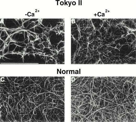Fig. 6. Scanning electron micrograph images of Tokyo II fibrin (γR275C) (A and B) and normal fibrin (C and D). Fibrin formed in HEPES pH 7 buffer (A and C) and formed in the same buffer containing 10 mmol/L CaCl2. (Reproduced from The Journal of Clinical Investigation, 1995, vol. 96, p. 1053, by copyright permission of The American Society for Clinical Investigation.100)