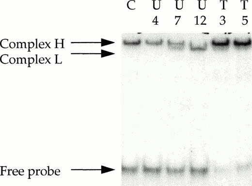 Fig. 3. Ku DEB activity in CLL extracts as determined by EMSA. Protein extracts (0.5 μg) obtained from purified B-CLL cells were incubated with 32P-labeled 25-bp DNA probe in the presence of 1 μg of closed circular plasmid DNA, as a nonspecific competitor. The electrophoretic mobility of the protein-DNA complexes were analyzed in a 12% polyacrylamide gel as described in Materials and Methods. The positions of protein-DNA complexes consisting of DNA-end binding activity are indicated (H, heterodimer that corresponds to full-length Ku 70/full-length Ku 86 subunits; L, heterodimer that corresponds to full-length Ku 70/variant Ku 86 subunits). U, untreated CLL lymphocytes; T, treated-resistant CLL lymphocytes; C, MO59K control cells.
