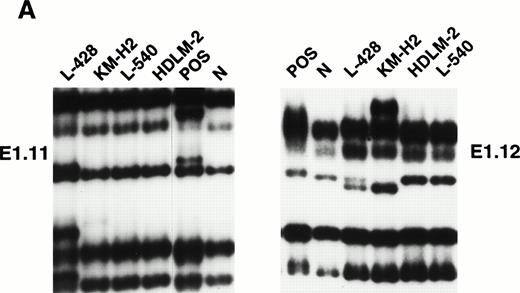 Fig. 3. Mutational analysis of the 5′ noncoding regions ofBCL-6 in HD cell lines. (A) Analysis by PCR-SSCP. Representative results obtained for PCR products E1.11 and E1.12 are shown. HD cell lines are indicated at the top of each lane by their conventional denomination. A positive control (POS), represented by a tumor sample known to harbor BCL-6 5' mutations, as well as a normal (N) sample, represented by a lymphoblastoid cell line, are also included for each PCR-SSCP fragment shown. Samples were scored positive when their migration pattern differed from the normal control (N) and the migration abnormalities could not be ascribed to population polymorphisms. Among the samples shown, cell lines scored as positive included L-428 for PCR products E1.11 and 1.12 and KM-H2 for PCR product E1.12. (B) Analysis by DNA direct sequencing. The nucleotide sequence of each case shown in the figure is matched to the sequence of a normal control (N) displaying germline BCL-6 alleles. The position of mutations is indicated (arrow) by the nucleotide number of the corresponding BCL-6 germline sequence (the first nucleotide of the BCL-6 cDNA was arbitrarily chosen as position +1).