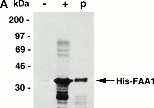 Fig. 1. Generation of an affinity-purified rabbit polyclonal antibody against FAA that specifically detects FAA in Western blotting and immunoprecipitation experiments. (A) Western blot showing the approximately 37-kD His-FAA1 fusion protein in bacterial extracts and after purification using the affinity-purified antibody. The His-tagged fusion protein encompasses the first 321 amino-terminal residues of FAA and was used to raise the antibody. Lysates derived from noninduced bacteria or isopropyl-β-thiogalactopyranoside (IPTG)-induced bacteria are indicated with (−) or (+), respectively, and the purified protein with (P). (B) Western blot using extracts derived from normal cells or cells representing five different FA complementation groups. The FAA-specific band of approximately 163 kD is indicated. Blots were reprobed with an anti–β-tubulin antibody as a control for the amount of protein loaded per lane. Lymphoblastoid cell lines used represent the following FA subtypes: HSC93 and nl, normal cells; HSC72 and HSC99, FA-A; HSC230, FA-B; HSC536, FA-C; HSC62, FA-D; EUFA130, FA-E. HSC72+FAA indicates HSC72 cells stably transduced with a retroviral vector expressing FAA. HSC99+FAA indicate cells that were stably transfected with an episomal expression vector containing the FAA cDNA. (C) Immunoprecipitation of FAA from whole-cell extracts, generated in RIPA buffer, from metabolically labeled COS1 cells either mock-transfected (−) or transiently transfected with pcDNA-FAA5.5 (+).