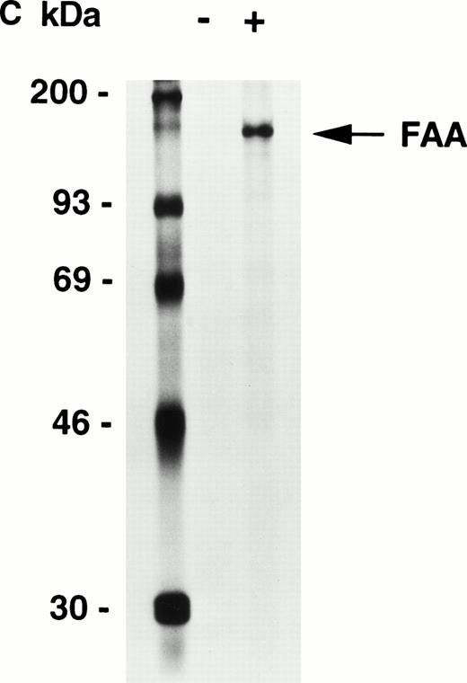 Fig. 1. Generation of an affinity-purified rabbit polyclonal antibody against FAA that specifically detects FAA in Western blotting and immunoprecipitation experiments. (A) Western blot showing the approximately 37-kD His-FAA1 fusion protein in bacterial extracts and after purification using the affinity-purified antibody. The His-tagged fusion protein encompasses the first 321 amino-terminal residues of FAA and was used to raise the antibody. Lysates derived from noninduced bacteria or isopropyl-β-thiogalactopyranoside (IPTG)-induced bacteria are indicated with (−) or (+), respectively, and the purified protein with (P). (B) Western blot using extracts derived from normal cells or cells representing five different FA complementation groups. The FAA-specific band of approximately 163 kD is indicated. Blots were reprobed with an anti–β-tubulin antibody as a control for the amount of protein loaded per lane. Lymphoblastoid cell lines used represent the following FA subtypes: HSC93 and nl, normal cells; HSC72 and HSC99, FA-A; HSC230, FA-B; HSC536, FA-C; HSC62, FA-D; EUFA130, FA-E. HSC72+FAA indicates HSC72 cells stably transduced with a retroviral vector expressing FAA. HSC99+FAA indicate cells that were stably transfected with an episomal expression vector containing the FAA cDNA. (C) Immunoprecipitation of FAA from whole-cell extracts, generated in RIPA buffer, from metabolically labeled COS1 cells either mock-transfected (−) or transiently transfected with pcDNA-FAA5.5 (+).