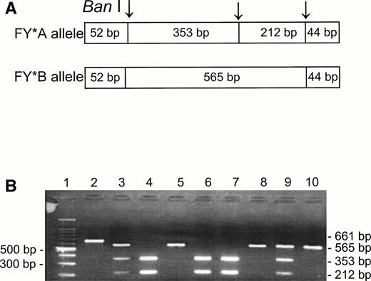 Fig. 1. Ban I RFLP for the identification of FY*A and FY*B alleles in non-Ashkenazi Jews. DNA was amplified using FY3 and FY4 primers for the amplification of a DARC fragment containing the 131G → A substitution, responsible for FY*A and FY*B, respectively. Restriction fragments were separated on 1% agarose gel. (A) Schematic diagram of fragments generated by the Ban I digestion of FY*A and FY*B DNA. (B) RFLP patterns of DNA from samples with the indicated phenotypes, identified by antisera (the 52- and 44-bp fragments are not detected in this gel). Lanes: 1, 100-bp ladder; 2, uncut; 3, 4, 6, 7, and 9, Fy (a+b−); 5, 8, and 10, Fy(a−b−).