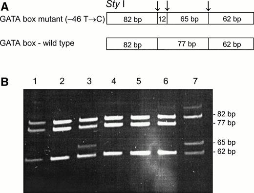 Fig. 2. Sty I RFLP for the identification of the GATA mutation (−46 T → C). DNA was amplified using FY1 and FY2 primers11 for the amplification of a DARC fragment encompassing nt −46. The restriction fragments were separated on 12% acrylamide gel. (A) Schematic diagram of fragments generated bySty I digestion of the DARC fragment encompassing nt −46 FY*B, GATA mutation. (B) RFLP patterns of DNA from samples with the indicated phenotyes, identified by antisera, and genotypes, as determined by Ban I (the 12-bp fragment is not detected in this gel). Lanes: 1, 2, and 4, Fy (a+b−)FY*A/FY*A; 3 and 7, Fy(a-b-)FY*B/FY*B; 5 and 6, Fy (a+b−)FY*A/FY*B.