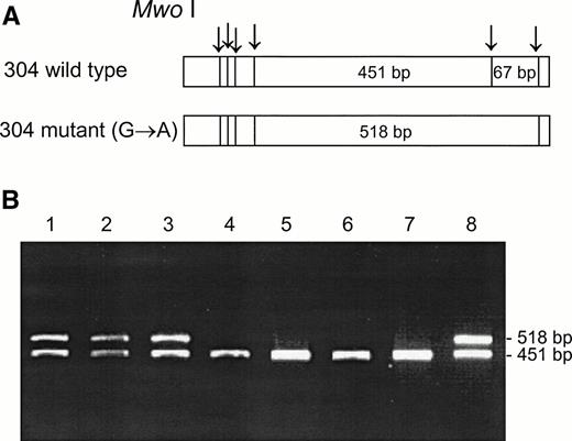 Fig. 4. Mwo I RFLP for the identification of the 304G → A mutation. DNA was amplified using the FY3 and FY4 primers. Restriction fragments were separated on 1% agarose gel. (A) Schematic diagram of fragments generated by Mwo I digestion of the DARC fragment encompassing nt 304. (B) RFLP patterns of DNA from samples with the indicated phenotypes, identified by antisera, and genotypes, determined by Ban I and Sty I (FY*B = wild-type GATA; FY*B− = GATA mutation). Lanes: 1 and 2, Fy(a+b−)FY*A/FY*B; 3 and 8, Fy(a−b−)FY*B/FY*B−; 4 and 5, Fy(a+b−)FY*A/FY*B−; 6 and 7, Fy (a−b−) FY*B−/FY*B−.