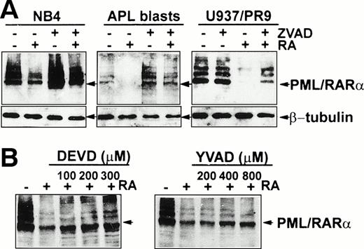 Fig. 1. Effect of the caspase inhibitors zVAD, DEVD, and YVAD in preventing RA-induced PML/RARα degradation. (A) Cells were treated with 1 μmol/L RA for 96 hours. U937/PR9 cells were induced to express PML/RARα by treatment with 100 μmol/L Zn for 16 hours. zVAD (100 μmol/L) was added for 1 hour before RA treatment. (B) Zn-induced U937/PR9 cells were treated with the indicated concentrations of DEVD or YVAD. Immunoblot analysis was performed on total cellular proteins (50 μg) using the anti-RARα RPα(F) antibody. Immunoreactivity to β-tubulin was used for loading control.