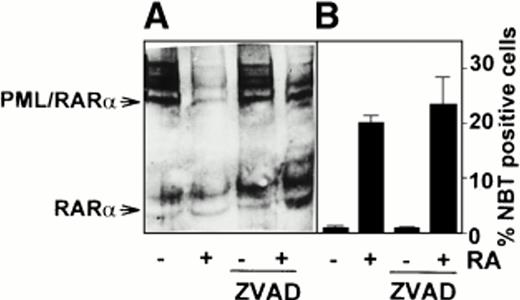 Fig. 5. Leukemic cells isolated from a newly diagnosed APL patient were treated for 96 hours with either 1 μmol/L RA or 100 μmol/L zVAD or with the combination of both agents as indicated. (A) Immunoblot analysis performed using the anti-RARα RPα(F) antibody; (B) percentage of differentiated cells determined by NBT reduction assay.