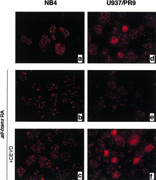 Fig. 6. Immunofluorescence analysis in NB4 (a through c) and Zn-induced U937/PR9 cells (e through g) using the PG-M3 anti-PML monoclonal antibody. Control cells (a and d) and cells treated for 96 hours with 1 μmol/L RA (b and e) or 1 μmol/L RA + 100 μmol/L DEVD (c and f).