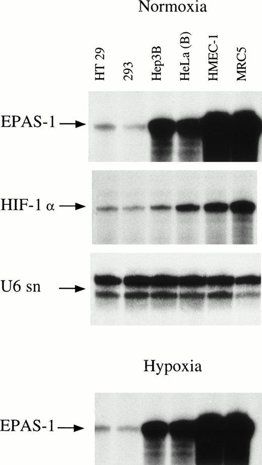Fig. 1. Expression of EPAS-1 and HIF-1α in six human cell lines. Cells were cultured in parallel for 4 hours in normoxia (upper three panels) and 1% hypoxia (lower panel). Ribonuclease protection analysis of total RNA was performed for EPAS-1 and HIF-1α (40 μg each), and U6 small nuclear RNA (1 μg).