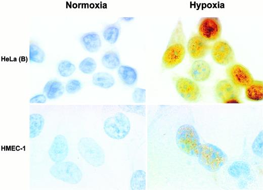 Fig. 4. Immunolabeling for EPAS-1 with MoAb 190b. Cells were exposed to normoxia (left panels) or 1% oxygen (right panels). Upper panels show HeLa(B) and lower panels HMEC-1. Nuclear labeling of variable intensity is seen in the hypoxic cells. Original magnification × 1,000.