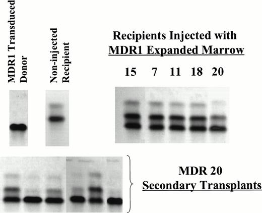 Fig. 3. Representative Hb electrophoresis gels from nonirradiated mice engrafted with expanded BM. C57 BM was used as the donor marrow for transduction and expansion. Recipient mice were HW80. The differing Hb patterns for donor and recipient are indicated (upper left). Primary recipients shown are MDR 7, 11, 18 (7 months post BMT), MDR 20 (5 months post-BMT) from experiment 1 and MDR 15 (3 months post-BMT) from experiment 2. Secondary irradiated recipients (HW80) were transplanted with marrow cells from MDR 20 (below) demonstrating persistence of donor engraftment 8 weeks after secondary transplant.