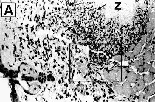 Fig. 5. Photomicrographs of zymosan-injected tissue in wild-type and E- and P-selectin–deficient mice. Ear tissue was removed 8 hours after zymosan injection and sections were stained with hematoxylin and eosin. (A) Wild-type mouse (original magnification × 400). Micro-abscess consisting of aggregates of zymosan (Z) surrounded and walled off by a rim of leukocytes (between arrowheads). The leukocytes are predominantly neutrophils, many of which have distorted morphology due to having phagocytized zymosan particles. Adjacent connective tissue also contains a neutrophilic infiltrate. (B) E- and P-selectin–deficient mouse (original magnification × 400). General features are similar to those described in (A). However, the overall intensity of the leukocyte infiltrate is markedly reduced in comparison with the wild-type mouse tissue. (C) Higher magnification of inset from (A) (original magnification × 1,000). Neutrophils (arrows) adherent to endothelial cells lining a venule in the vicinity of a micro-abscess.