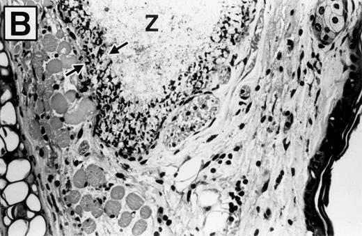 Fig. 5. Photomicrographs of zymosan-injected tissue in wild-type and E- and P-selectin–deficient mice. Ear tissue was removed 8 hours after zymosan injection and sections were stained with hematoxylin and eosin. (A) Wild-type mouse (original magnification × 400). Micro-abscess consisting of aggregates of zymosan (Z) surrounded and walled off by a rim of leukocytes (between arrowheads). The leukocytes are predominantly neutrophils, many of which have distorted morphology due to having phagocytized zymosan particles. Adjacent connective tissue also contains a neutrophilic infiltrate. (B) E- and P-selectin–deficient mouse (original magnification × 400). General features are similar to those described in (A). However, the overall intensity of the leukocyte infiltrate is markedly reduced in comparison with the wild-type mouse tissue. (C) Higher magnification of inset from (A) (original magnification × 1,000). Neutrophils (arrows) adherent to endothelial cells lining a venule in the vicinity of a micro-abscess.
