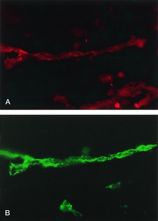 Fig. 2. Immunofluorescence photomicrographs of vascular selectin expression in zymosan-injected ears in wild-type mice. Tissue was prepared for immunofluorescent microscopy 6 hours after subcutaneous zymosan injection and intravenous administration of R-phycoerythrin–conjugated anti–E-selectin antibody and fluorescein-conjugated anti–P-selectin antibody. Photomicrographs (original magnification × 400) were taken adjacent to a subcutaneous zymosan deposit and represent the fluorescence associated with a single tubular, branching vascular structure as viewed with appropriate filters for (A) R-phycoerythrin (anti–E-selectin) or (B) fluorescein (anti–P-selectin).
