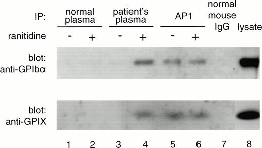 Fig. 4. Platelet GPIbα and GPIX were precipitated by antibody JH in the presence (lane 4), but not in the absence (lane 3), of ranitidine. Monoclonal AP1, specific for GPIbα precipitated GPIbα and GPIX both in the presence (lane 6) and absence (lane 5) of drug. No bands were precipitated by normal plasma (lanes 1 and 2) or by normal mouse IgG (lane 7). GPIbα and GPIX were demonstrated by Western blotting with monoclonals MBC142.11 and GR-P, under reducing and nonreducing conditions, respectively.