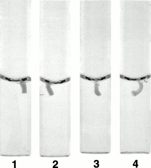 Fig. 4. Photograph of clots after 20 minutes. Clot retraction experiments were performed as described in Fig 3A and a photograph of the tubes containing the clots was taken after 20 minutes. The photograph is representative of the results observed in all four experiments performed. Tubes: 1, normal recombinant fibrinogen; 2, recombinant Aα D97E fibrinogen; 3, recombinant Aα D574E fibrinogen; 4, recombinant Aα DE2/γ 407 fibrinogen.