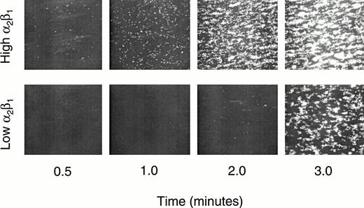 Fig. 3. Video microscopy of platlet attachment to human type I collagen at high shear (1,500/s). Real-time epifluorescence video microscopy showing the time courses of platelet adhesion in whole blood to surface-bound solubilized human type I collagen at 1,500/s. Single-frame images obtained during a typical comparison are depicted. These data, derived from one donor pairwise analysis, are representative of results obtained from six donors. Upper row: normal donor, homozygous allele 1 (807T) genotype, High platelet α2β1 density; bottom row: normal donor, homozygous allele 2 (807C) genotype, Low platelet α2β1 density. Time after initiation of whole blood flow is shown above each column. Platelet α2β1 density was determined by flow cytometry and is expressed as a normalized mean fluorescence intensity (nMFI).9 The range of nMFI for 32 normal subjects is 1.0 to 9.4. In the experiment depicted here, the nMFI values for each donor are: High, 9.2; Low, 2.2.