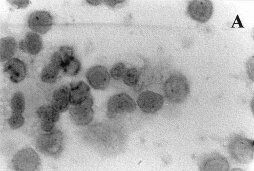 Fig. 7. Photomicrographs (1,000 × magnification) showing perforin expression in cytoplasmic granules. PBL from adults: (A) time 0; (B) 24 hours IL-2 culture. PBL from elderly persons: (C) time 0; (D) 24 hours IL-2 culture. Arrows in (C) indicate granules in the cytoplasm of elderly persons stained light, but clearly positive for perforin.