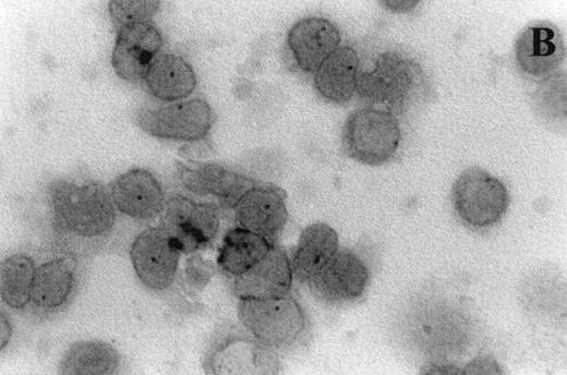 Fig. 7. Photomicrographs (1,000 × magnification) showing perforin expression in cytoplasmic granules. PBL from adults: (A) time 0; (B) 24 hours IL-2 culture. PBL from elderly persons: (C) time 0; (D) 24 hours IL-2 culture. Arrows in (C) indicate granules in the cytoplasm of elderly persons stained light, but clearly positive for perforin.