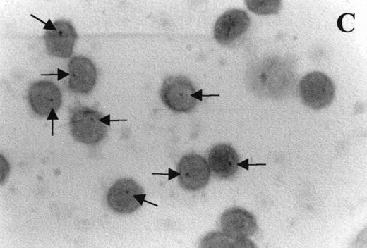 Fig. 7. Photomicrographs (1,000 × magnification) showing perforin expression in cytoplasmic granules. PBL from adults: (A) time 0; (B) 24 hours IL-2 culture. PBL from elderly persons: (C) time 0; (D) 24 hours IL-2 culture. Arrows in (C) indicate granules in the cytoplasm of elderly persons stained light, but clearly positive for perforin.