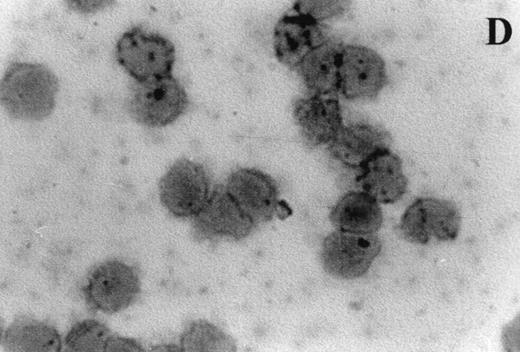 Fig. 7. Photomicrographs (1,000 × magnification) showing perforin expression in cytoplasmic granules. PBL from adults: (A) time 0; (B) 24 hours IL-2 culture. PBL from elderly persons: (C) time 0; (D) 24 hours IL-2 culture. Arrows in (C) indicate granules in the cytoplasm of elderly persons stained light, but clearly positive for perforin.
