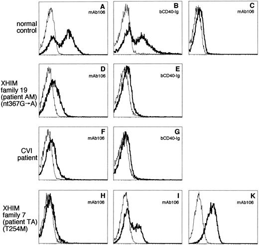 Fig. 1. CD40L expression by activated PBMC, T-cell lines, and CD4+ T-cell clones. After stimulation with ionomycin and PMA for 8 hours (PBMC) or 4 hours (T-cell lines and CD4+T-cell clones), immunostaining of cells was performed using MoAb 106 or bCD40-Ig. The immunostaining with MoAb 106 or bCD40-Ig is shown by a bold line and the immunostaining with isotype-matched control reagent is indicated by a thin line. The fluorescence intensity is expressed on the abscissa on a log scale and the number of events is expressed on the ordinate. (A and B) Activated PBMC from a normal control; (C) PBMC from a normal control without activation; (D and E) activated PBMC from patient AM (family 19) with the splice site mutation in exon 3 (nt 367G → A); (F and G) activated PBMC from a CVI patient with confirmed normal CD40L sequence; (H, I, and K) patient TA (family 7) with the missense mutation T254M and includes activated PBMC (H), an activated T-cell line (I), and an activated CD4+ T-cell clone (K).