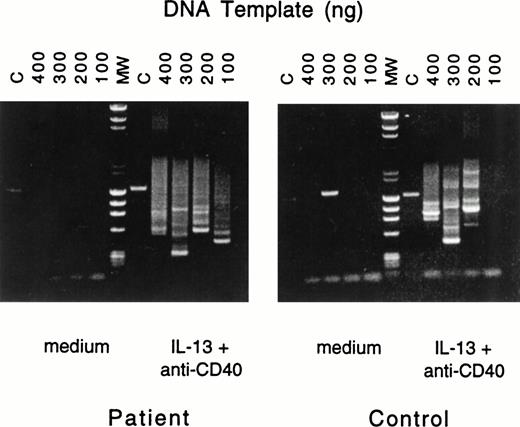 Fig. 1. Nested PCR amplification of switch fragments. Serially diluted aliquots of DNA from PBMCs of patient no. 2 (left) or control (right), cultured with medium or with IL-13 plus anti-CD40 MoAb, were amplified by nested primer PCR. The quantities of serially diluted template DNA used in the first round of PCR are noted above the gel; in the second round of PCR 10% of the original PCR reaction mixture was used as DNA template. Final PCR products were analyzed by agarose gel electrophoresis. In the control lane (C), primers specific for the human IL-1β promoter yielded the expected 1.4-kb fragment. Lane MW represents the molecular-weight markers.