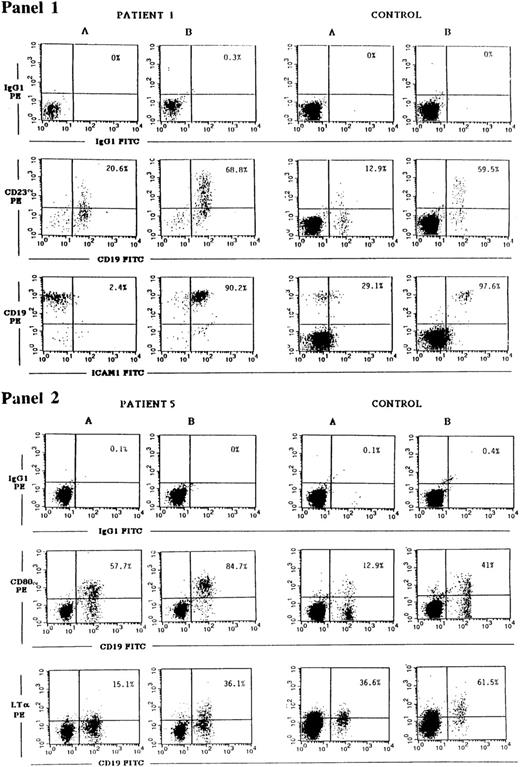 Fig. 2. Upregulation of CD23, ICAM-1, CD80, and LT-α expression on JAK3-deficient B cells in response to CD40 ligation. PBMCs from patient no. 1 obtained pre-BMT or patient no. 5 (left panels), or from controls (right panels), were cultured for 24 hours with medium (A) or with soluble mouse CD40L:CD8 plus rat anti-mouse CD8 (B). Cells were then washed and stained with either CD19-FITC plus CD23-PE MoAbs, with CD19-PE plus ICAM-1-FITC MoAbs (panel 1), with CD19-FITC plus CD80-PE or biotinylated LT-α MoAbs followed by strepavidin-PE (panel 2), or with the appropriate isotype controls. Cells were then analyzed using a FACScalibur flow cytometer. Percentages shown in the upper right quadrant of each dot plot represent the percent of CD23+, ICAM-1+, CD80+, or LT-α+ B cells detected.