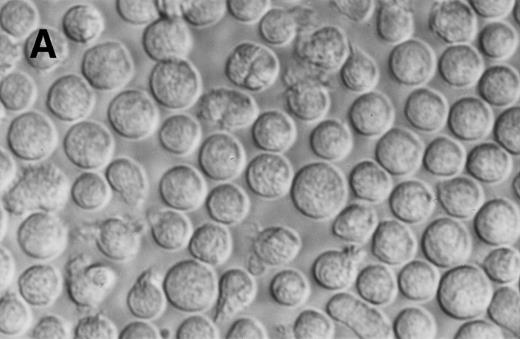 Fig. 5. Phase contrast photomicrograph showing the morphology of CD34+CD38− CML cells cultured in the pre-CFU assay for 24 days with SCF alone or with 4HGF (original magnification 200×). (A) SCF-stimulated cells; (B) 4HGF-stimulated cells.