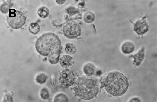 Fig. 5. Phase contrast photomicrograph showing the morphology of CD34+CD38− CML cells cultured in the pre-CFU assay for 24 days with SCF alone or with 4HGF (original magnification 200×). (A) SCF-stimulated cells; (B) 4HGF-stimulated cells.