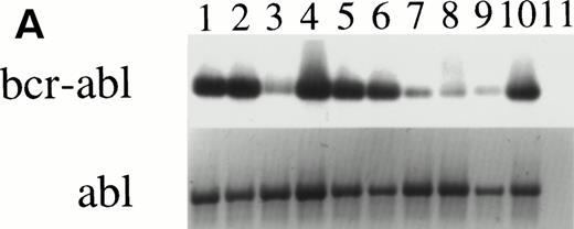 Fig. 7. RT-PCR of individual granulocyte-macrophage colonies derived from CML cells after culture in the pre-CFU assay. (A) Lanes 1 to 10: PCR of ten individual colonies derived from cells cultured in SCF alone for 14 days, then transferred into the CFU-GM assay for 14 days. Lane 11 is a CFU-GM culture medium negative control. (B) Lanes 1 to 8: PCR of eight individual colonies derived from cells cultured in 4HGF for 14 days, then transferred into the CFU-GM assay for 14 days. Lane 9 is a CFU-GM culture medium negative control.