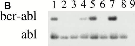Fig. 7. RT-PCR of individual granulocyte-macrophage colonies derived from CML cells after culture in the pre-CFU assay. (A) Lanes 1 to 10: PCR of ten individual colonies derived from cells cultured in SCF alone for 14 days, then transferred into the CFU-GM assay for 14 days. Lane 11 is a CFU-GM culture medium negative control. (B) Lanes 1 to 8: PCR of eight individual colonies derived from cells cultured in 4HGF for 14 days, then transferred into the CFU-GM assay for 14 days. Lane 9 is a CFU-GM culture medium negative control.