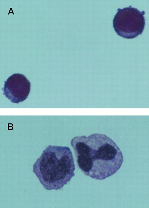 Fig. 4. Jenner Giemsa stain showing the morphology of CD34+CD38− CML cells cultured in the pre-CFU assay for 14 days with SCF alone, or with 4HGF (original magnification 200×). (A) SCF-stimulated cells; (B) 4HGF-stimulated cells.
