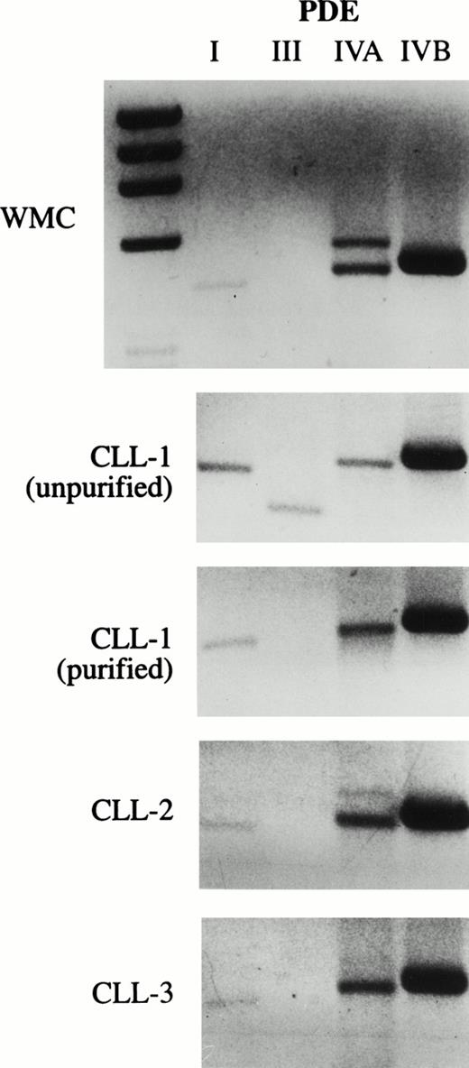 Fig. 1. CLL cells contain transcripts for PDE 1B1, PDE4A, and PDE4B. PCR was performed on cDNA derived from WMC (purified from a normal donor) or CLL cells for PDE1, PDE3A, PDE4A, and PDE4B. The cDNA used in the PCR in the bottom three panels was derived from leukemic cells from three different patients purified by positive selection for CD19 expression. The lowest band in the MWM lane on the left in the upper panel is 603 bp. Expected PCR product sizes for PDE1, 3A, 4A, and 4B are 430, 340, 461, and 470 bp, respectively.