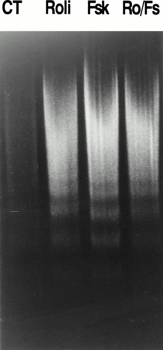 Fig. 5. Rolipram and forskolin induce DNA fragmentation in CLL cells. Soluble DNA was isolated from 10 million CLL cells cultured for 72 hours in media (CT), 10 μmol/L rolipram (Roli), 40 μmol/L forskolin (Fsk) or a combination of the latter two agents (Ro/Fs). DNA fragments were resolved by electrophoresis on a 1.5% agarose gel and visualized with ethidium bromide. These data are representative of the four leukemic cell samples tested.