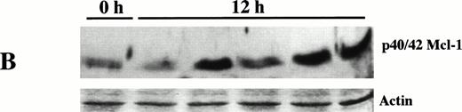 Fig. 4. Expression of Mcl-1 in neutrophils treated to delay apoptosis. Expression of Mcl-1 in freshly isolated neutrophils and neutrophils cultured for 6 hours (A) and 12 hours (B) in the conditions indicated, were determined by Western blotting as described in Materials and Methods. Ponceau S–stained actin is shown for comparison of protein loading per lane. Each treatment shown is representative of at least two separate experiments.