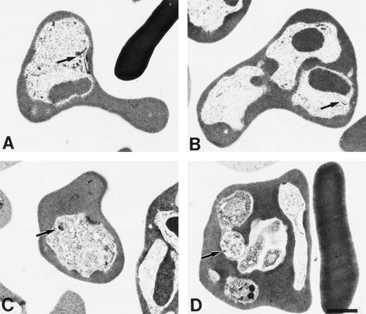 Fig. 6. Electron micrographs of γ (A and B) and normal (C and D) mice infected with P chabaudi adami taken at 10:30am (A and C) and 6:30 pm (B and D).