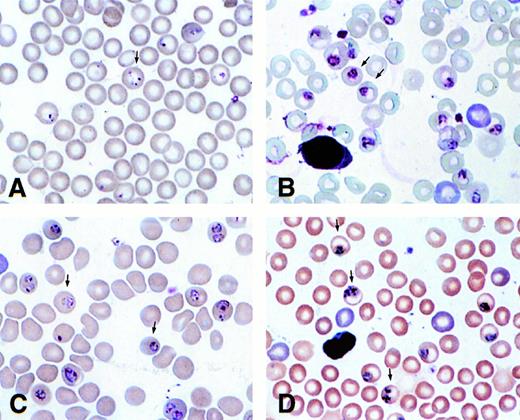 Fig. 4. Blood smears of γ (A and B) and normal (C and D) mice infected with P chabaudi adami taken at 10:30 am (A and C) and 6:30 pm (B and D).