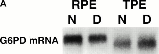 Fig. 1. (A) Expression of the P falciparum G6PD gene in parasites grown in normal and deficient E. Total P falciparumRNA (strain HB3B) was analyzed by Northern blot using K2O2 as a probe (see Materials and Methods). Approximately 4 μg of total RNA extracted from parasites grown in normal (N) and deficient (D) E at ring (RPE) and trophozoite (TPE) stage of the first growth cycle. Illustrative lanes are labeled at the top with the respective G6PD status. (B) Expression of the P falciparum G6PD gene in peripheral blood of patients infected with P falciparummalaria. Total RNA was extracted from the peripheral blood of two P falciparum–infected G6PD normal patients and analyzed as indicated above. Patient 1: Total RNA extracted from 2 mL of peripheral blood from a patient with a parasitemia of 0.25% RPE, corresponding to approximately 1.8 × 107 parasitized E. Patient 2: Total RNA extracted from 3 mL of peripheral blood from a patient with a parasitemia of 0.6% RPE, corresponding to approximately 8 × 107 parasitized E. RPE: 4.5 μg of total RNA extracted from in vitro culture (ring stage) of strain C1O.