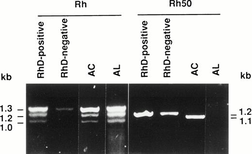 Fig. 1. Reverse transcription-PCR (RT-PCR) amplification of reticulocyte RNAs from AC and AL Rhnullpatients. The Rh and Rh50 cDNAs were amplified by RT-PCR from reticulocyte mRNAs as described in Materials and Methods. The Rh50 amplification products showed a smaller size in patient AC as compared with RhD-negative or RhD-positive controls, and no product is present in AL.