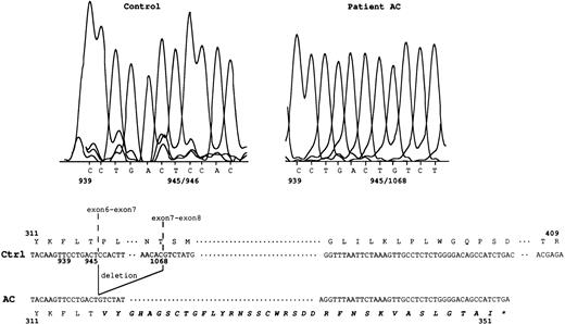 Fig. 2. Rh50 transcript analysis in patient AC. In the control sample, nt 945/946 correspond to the exon 6-exon 7 junction. In patient AC, a 122-bp deletion (nt 946 to 1067, ie, the entire transcribed exon 7 region) results in a new junction, nt 945/1068. This deletion introduced a frameshift resulting in 36 novel amino acids (in bold italics) at the C-terminal region, after the threonine at position 315. Ctrl, normal Rh50 cDNA.5 The star identifies the stop codon located in exon 9. Junctions of exons 6-7 and exons 7-8 are shown.
