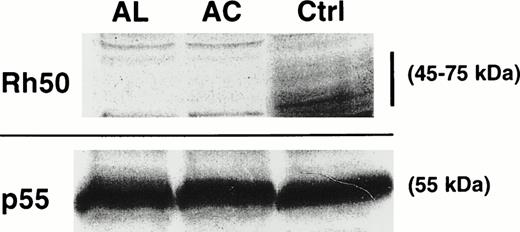 Fig. 3. Immunostaining of RBC membrane proteins from AC and AL erythrocytes. The Rh50 glycoprotein carries a N-linked polylactosylaminyl carbohydrate chain and is shown as a diffuse band of 45 to 75 kD in the RhD-positive control (Ctrl) using an antibody directed against the Rh50 N-terminus. No signal was detected in both AC and AL. All samples exhibited equivalent amounts of p55.