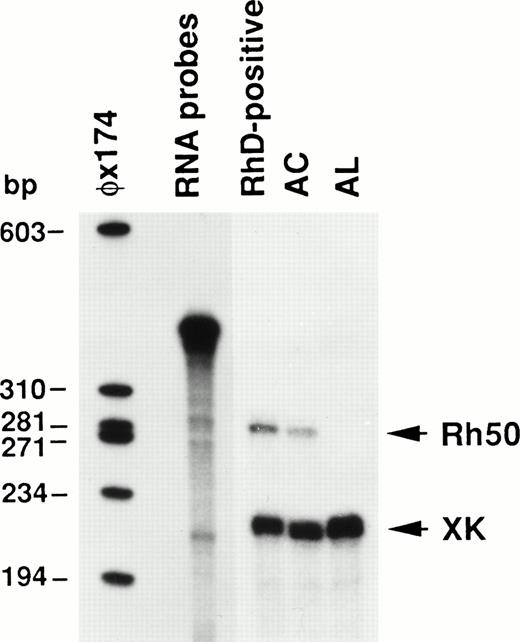 Fig. 6. Ribonuclease protection analysis of Rh50 mRNAs. Total reticulocyte RNAs (12.5 μg) protected a 270 nt Rh50 fragment and a 207 nt XK fragment. Rh50 mRNA levels in AC, compared after normalizing them to the XK internal standard, were about 54% of those detected in the RhD-positive control. No Rh50 mRNA was detected in AL. RNA probes of 396 nt and 333 nt for Rh50 and XK, respectively, migrate very close to each other in the gel. A radiolabeled HaeIII digest of phage ◊X174 was used as a size marker.