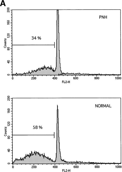 Fig. 1. Granulocytes from PNH patients resist apoptosis as compared with normal granulocytes. Freshly purified granulocytes were serum starved and then analyzed for evidence of apoptosis. (A) PNH granulocytes at 12 hours were stained with propidium iodide and analyzed by flow cytometry. The narrow, tall peak on each histogram represents cells with a normal (2n) amount of DNA, whereas the broader peak represents apoptotic cells with a sub-2n amount of DNA. The granulocytes from a PNH patient have less apoptosis (34% sub-2n PI staining) than those from a normal control (58%). (B) Cells at 6 hours were stained with annexin V-FITC and PI to identify apoptotic cells that are positive for annexin binding but exclude PI. The granulocytes from a PNH patient have less apoptosis (26% annexin V-FITC staining) than those from a normal control (59%). (C) Genomic DNA was analyzed for fragmentation. At time zero no laddering was observed, but after 12 hours of serum starvation, DNA from PNH granulocytes had less laddering than the DNA from the granulocytes of a normal control.
