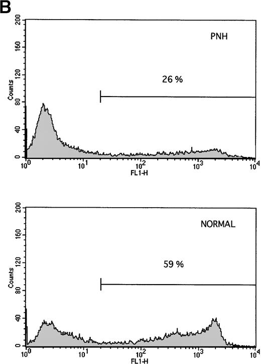 Fig. 1. Granulocytes from PNH patients resist apoptosis as compared with normal granulocytes. Freshly purified granulocytes were serum starved and then analyzed for evidence of apoptosis. (A) PNH granulocytes at 12 hours were stained with propidium iodide and analyzed by flow cytometry. The narrow, tall peak on each histogram represents cells with a normal (2n) amount of DNA, whereas the broader peak represents apoptotic cells with a sub-2n amount of DNA. The granulocytes from a PNH patient have less apoptosis (34% sub-2n PI staining) than those from a normal control (58%). (B) Cells at 6 hours were stained with annexin V-FITC and PI to identify apoptotic cells that are positive for annexin binding but exclude PI. The granulocytes from a PNH patient have less apoptosis (26% annexin V-FITC staining) than those from a normal control (59%). (C) Genomic DNA was analyzed for fragmentation. At time zero no laddering was observed, but after 12 hours of serum starvation, DNA from PNH granulocytes had less laddering than the DNA from the granulocytes of a normal control.