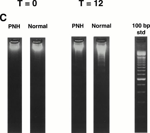 Fig. 1. Granulocytes from PNH patients resist apoptosis as compared with normal granulocytes. Freshly purified granulocytes were serum starved and then analyzed for evidence of apoptosis. (A) PNH granulocytes at 12 hours were stained with propidium iodide and analyzed by flow cytometry. The narrow, tall peak on each histogram represents cells with a normal (2n) amount of DNA, whereas the broader peak represents apoptotic cells with a sub-2n amount of DNA. The granulocytes from a PNH patient have less apoptosis (34% sub-2n PI staining) than those from a normal control (58%). (B) Cells at 6 hours were stained with annexin V-FITC and PI to identify apoptotic cells that are positive for annexin binding but exclude PI. The granulocytes from a PNH patient have less apoptosis (26% annexin V-FITC staining) than those from a normal control (59%). (C) Genomic DNA was analyzed for fragmentation. At time zero no laddering was observed, but after 12 hours of serum starvation, DNA from PNH granulocytes had less laddering than the DNA from the granulocytes of a normal control.