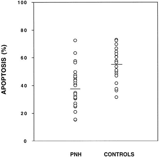 Fig. 2. Granulocytes from PNH patients are relatively resistant to apoptosis as compared with granulocytes from normal controls. Cells were tested in triplicate and the mean is plotted for each patient (○). The mean for each group is shown as a horizontal line. The amount of apoptosis as measured by flow cytometry was significantly less for PNH granulocytes (38.8% ± 14.1%, n = 26) as compared with normal granulocytes (55.0% ± 12.0%, n = 20), P < .001. There was some overlap for individuals within each group.