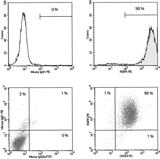 Fig. 4. Stable transduction with the PIG-A cDNA sequence. The GPI-negative JY5 cell line was transduced with supernatants from either the MN (mock control) vector or the MPIN vector. After sorting, cells were analyzed for the surface expression of NGFR, which indicates successful transduction of the retroviral sequence, and CD59, which indicates a functioning PIG-A sequence. Upper left panel: JY5 with MN vector, control antibody. Upper right panel: JY5 with MN vector, NGFR-PE antibody, showing 98% surface expression of NGFR. Lower left panel: JY5 with MPIN vector, control antibodies. Lower right panel: JY% with MPIN vector, CD59-FITC and NGFR-PE antibodies, showing 98% surface expression of both NGFR and CD59, indicating successful transduction of the vector and a functioning PIG-A sequence.